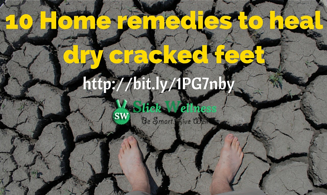 How To Cure Cracked Feet Using Home Remedies