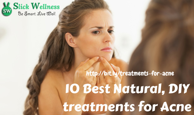 10 Best Natural, DIY treatments for Acne