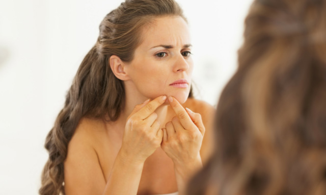 DIY-treatments-for-Acne