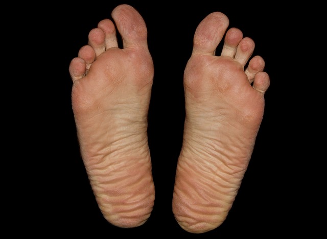 How to remove dead skin from your feet