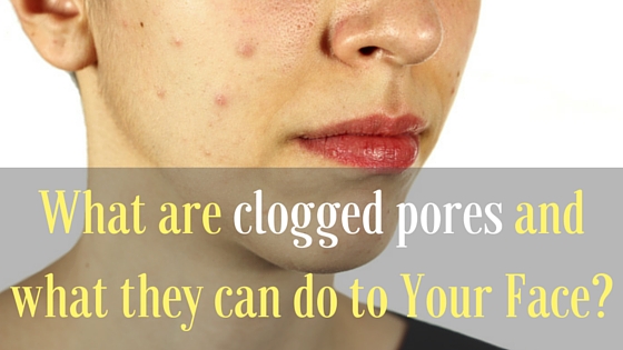 Clogged Facial Pores 119