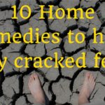 Home remedies to heal dry cracked feet