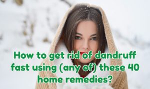 Get Rid of Dandruff