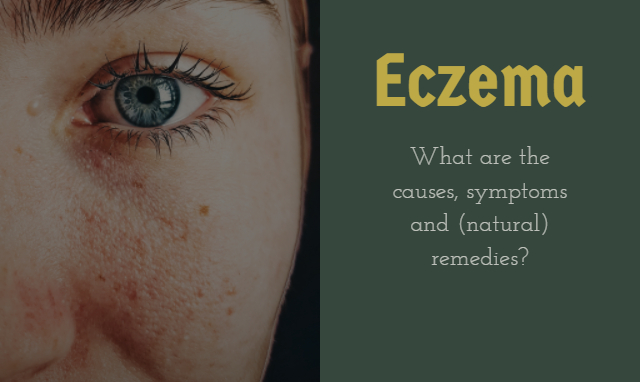 Eczema: Causes, symptoms and natural remedies 