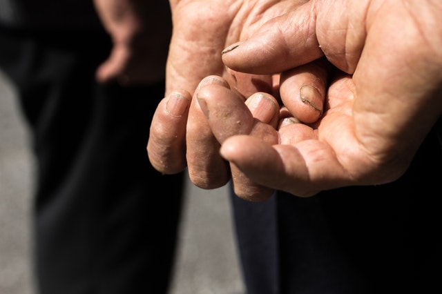 Nails speak for uncontrolled health Issues