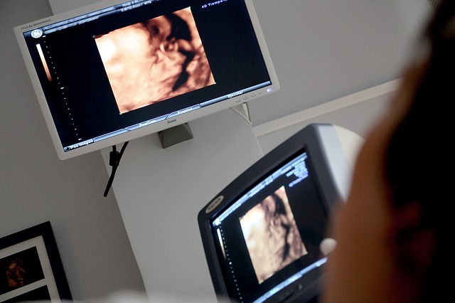 Benefits and Risks of Ultrasound During Pregnancy 3 Identification of chromosomal abnormalities