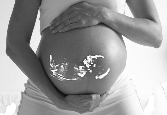 Benefits and Risks of Ultrasound During Pregnancy