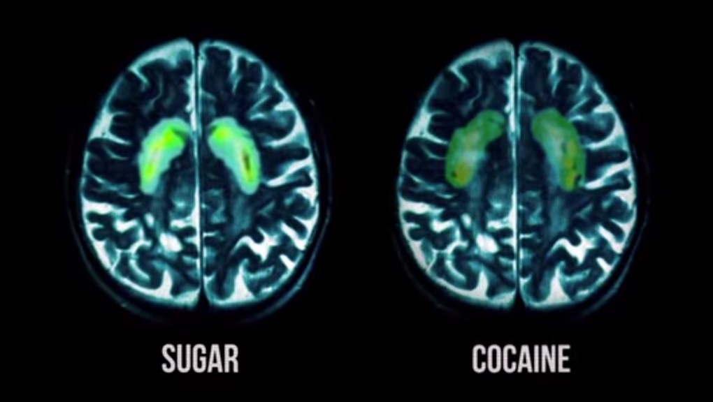 How to do a Sugar Detox perfectly and combat the cravings 3 cocaine