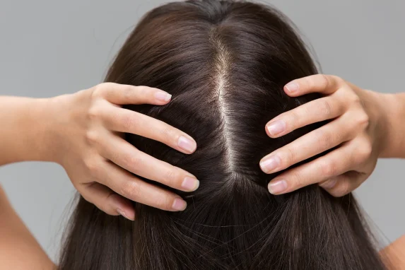 Maintain a Healthy Scalp